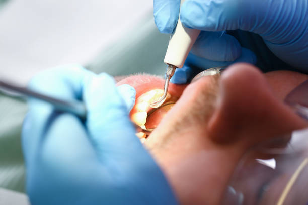 Best Walk-In Emergency Dental Services in Mercer Island, WA