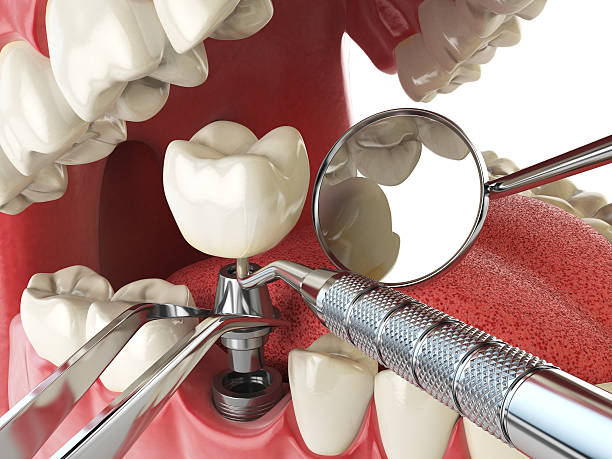 Best Emergency Treatment for Jaw Pain or Injury in Mercer Island, WA