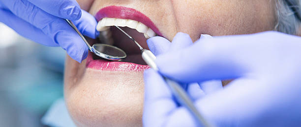 Best Dental Abscess Treatment in Mercer Island, WA